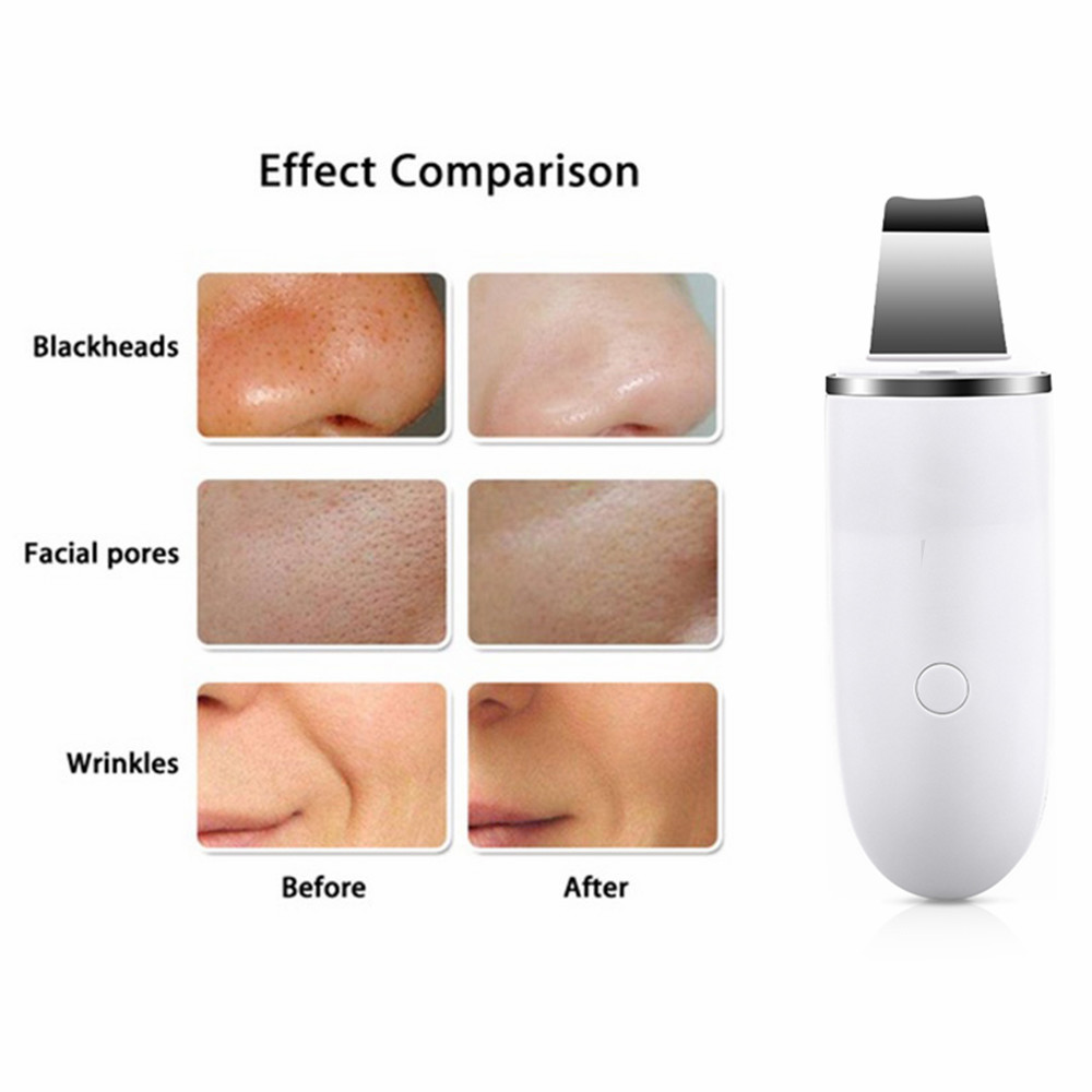 Ultrasonic Skin Scrubber Deep Face Cleaning Peeling Shovel Facial Pore Cleaner Face Skin Scrubber Lift Machine