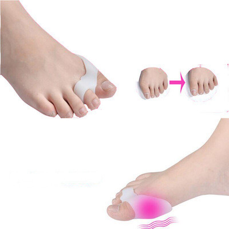 soin orthopédique des pieds, 2 pièces = 1 paire, attelle spéciale, protection du pouce en Gel de Silicone, séparateur d'orteils, redresseur, outils de soins
