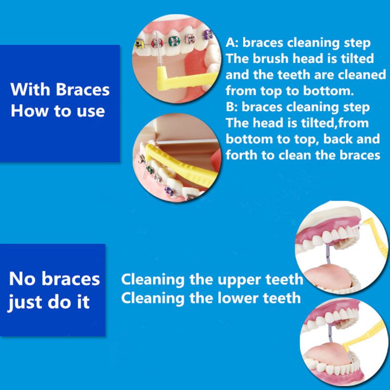 20 Stuks Rager L Vormige Superfijne Tandenstokers Push Pull Tooth Cleaner Tanden Whitening Kauwgom Care Mondhygiëne Met Case