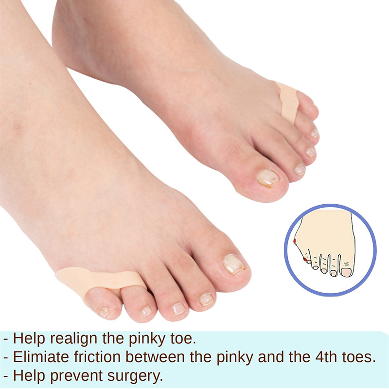 Pexmen 2Pcs Gel Pinky Toe Separator Bunionette Corrector Bunion Pads Little Toe Protector Pain Relief Spacer Foot Care Tool