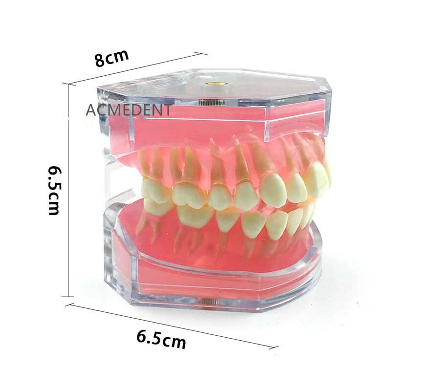 Dental Study Teaching Model Standard Model Removable Teeth Soft Gum Adult Typodont Model 3 Type: B X1Pcs