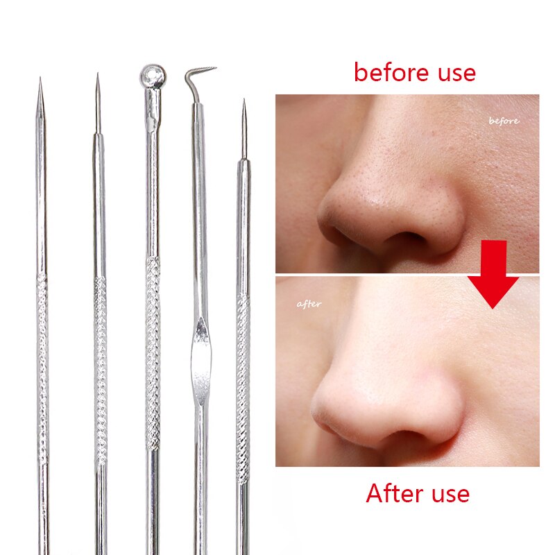Stainless Steel Pimple Acne Extractor Blackhead Remover Needles Pimple Blemish Acne Treatments Face Skin Care Tools Needles Set