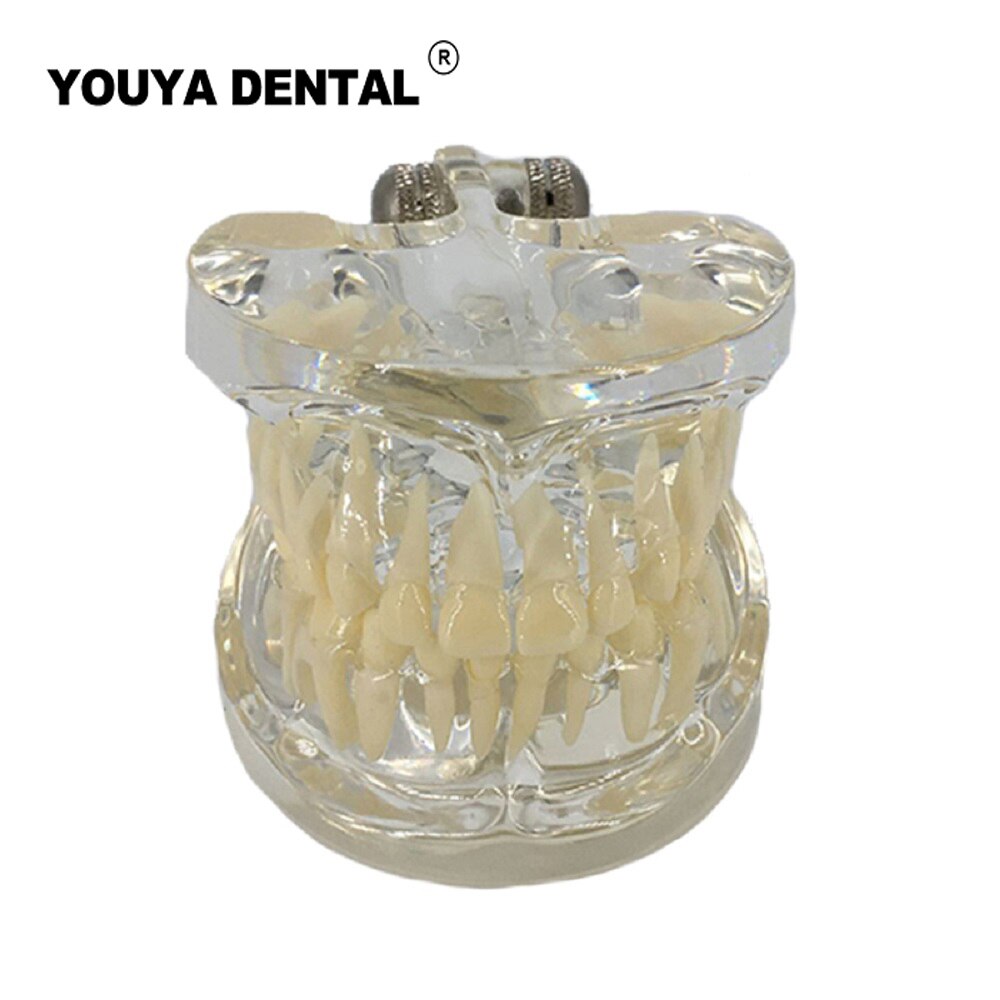 Dental Teaching Model Children Deciduous Tooth Permanent Teeth Alternating Study Pediatric Dental Pathology Preventive Model: Type 2