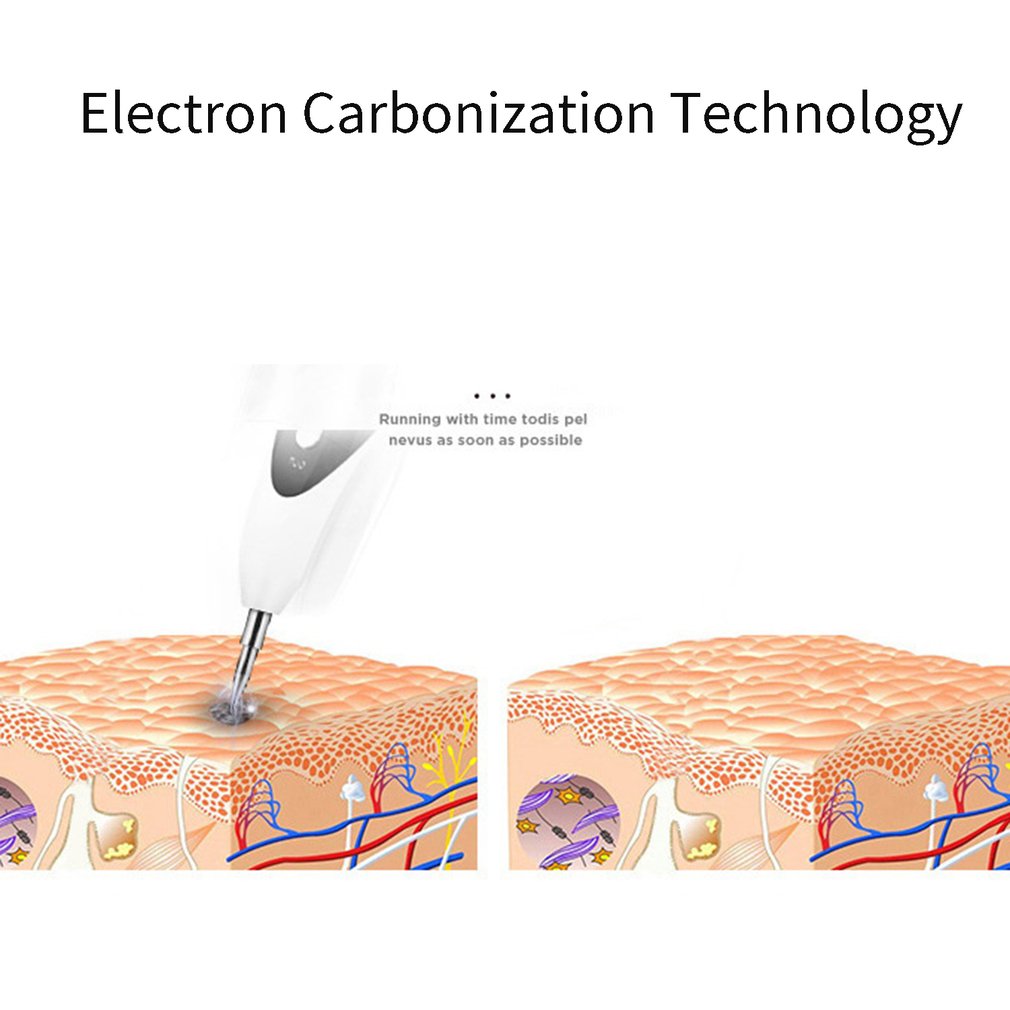 Portable Light Facial Beauty Instrument Home Lcd 9 File Remove Mole Pen Micro Freckle Pen Sweep Spot Machine