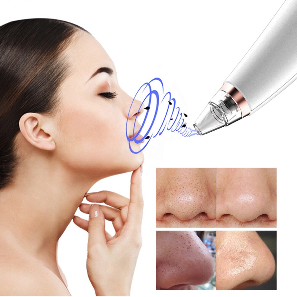 Electric Blackhead Remover Vacuum Suction Facial Pore Cleaner w/Suction Tip Black Spots Pore Cleaner Machine