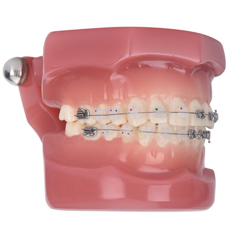 Teeth Model Implant Disease Teeth Model Dentist Studying Model