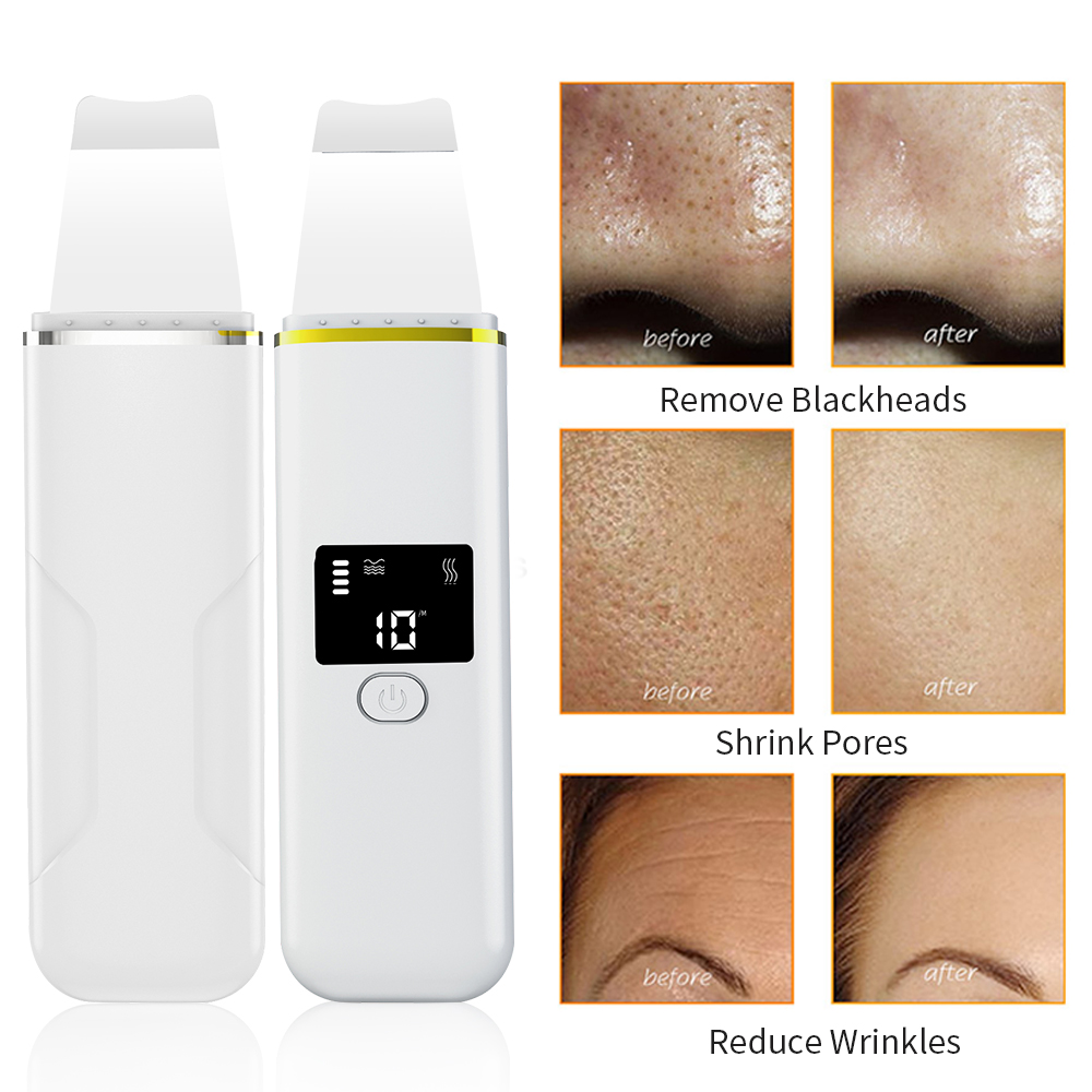 Espátula Facial de iones de ultrasonido, limpiador de poros, masajeador de limpieza profunda, Lifting de la piel, eliminación de espinillas, pala exfoliante Facial