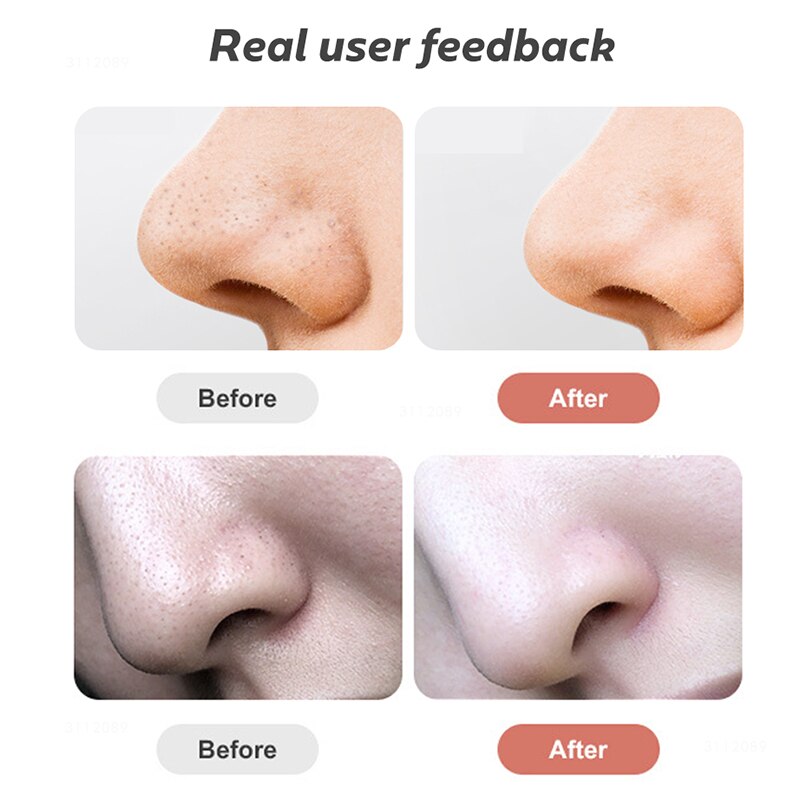 Blackhead Remover Face Deep Nose Cleaner T Zone Pore Acne Pimple Removal Vacuum Suction Facial Diamond Beauty Clean Skin Tool Bl