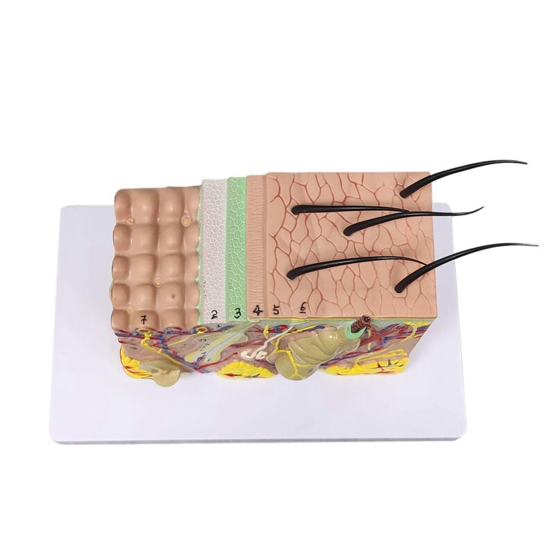 Skin Model, 35X Vergroot Anatomisch Model Anatomie Voor Science Classroom Studie Display Onderwijs Model
