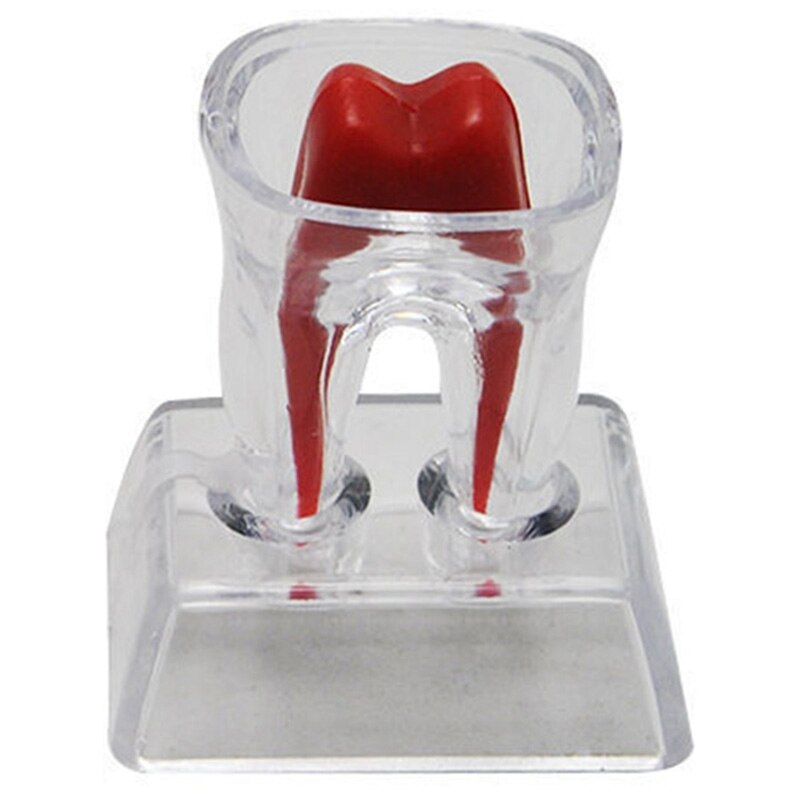 Large Tooth Molar Model Separable Teaching Demonstration Model Transparent Dentistry Material Lab Teeth Model