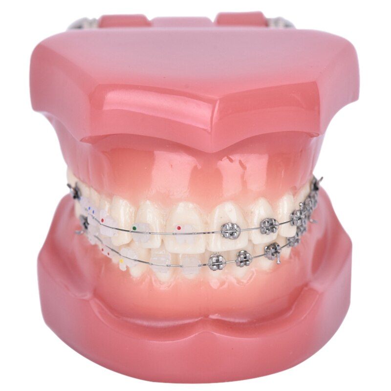 Teeth Model Implant Disease Teeth Model Dentist Studying Model: Default Title