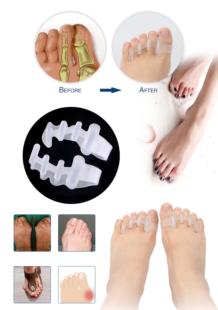 1 Pair Silicone Toe Separator Toes Overlapping Separator Toes Orthotics Hallux Valgus Care Foot Toes Rehabilitation Gel Insoles