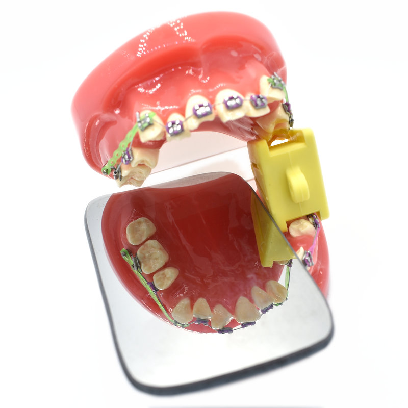 5 stk dentalt intraoralt okklusalt dobbeltsidet fotografisk glasspejl
