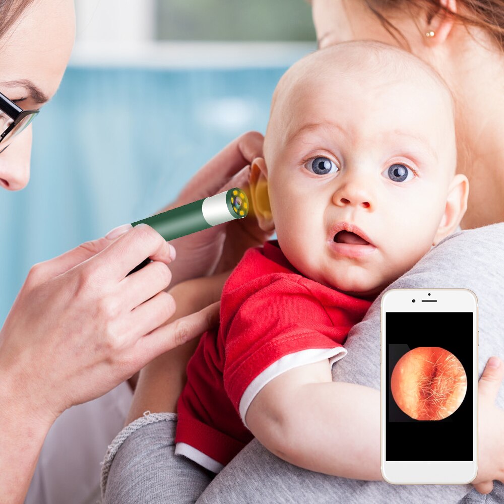 Caméra d'endoscope auriculaire, led réglables, lentille 5.5MM, résolution 640*480, IP67, résistance à l'eau, Otoscope d'inspection