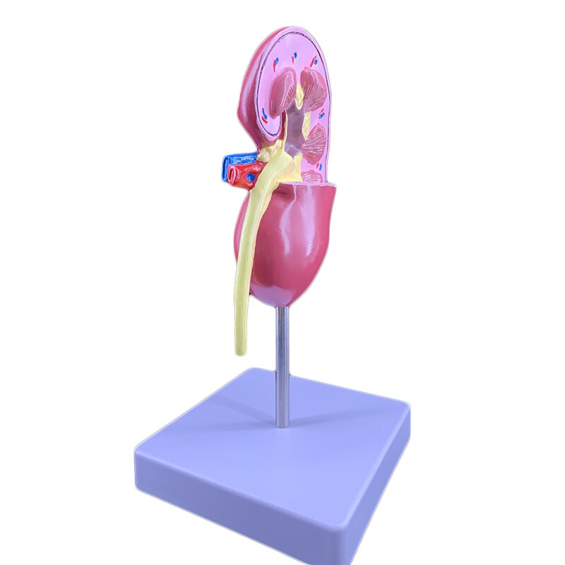 Menselijke Nier Anatomisch Model Laesie Nier Onderwijs Demonstratie Model Onderwijs Gebruik