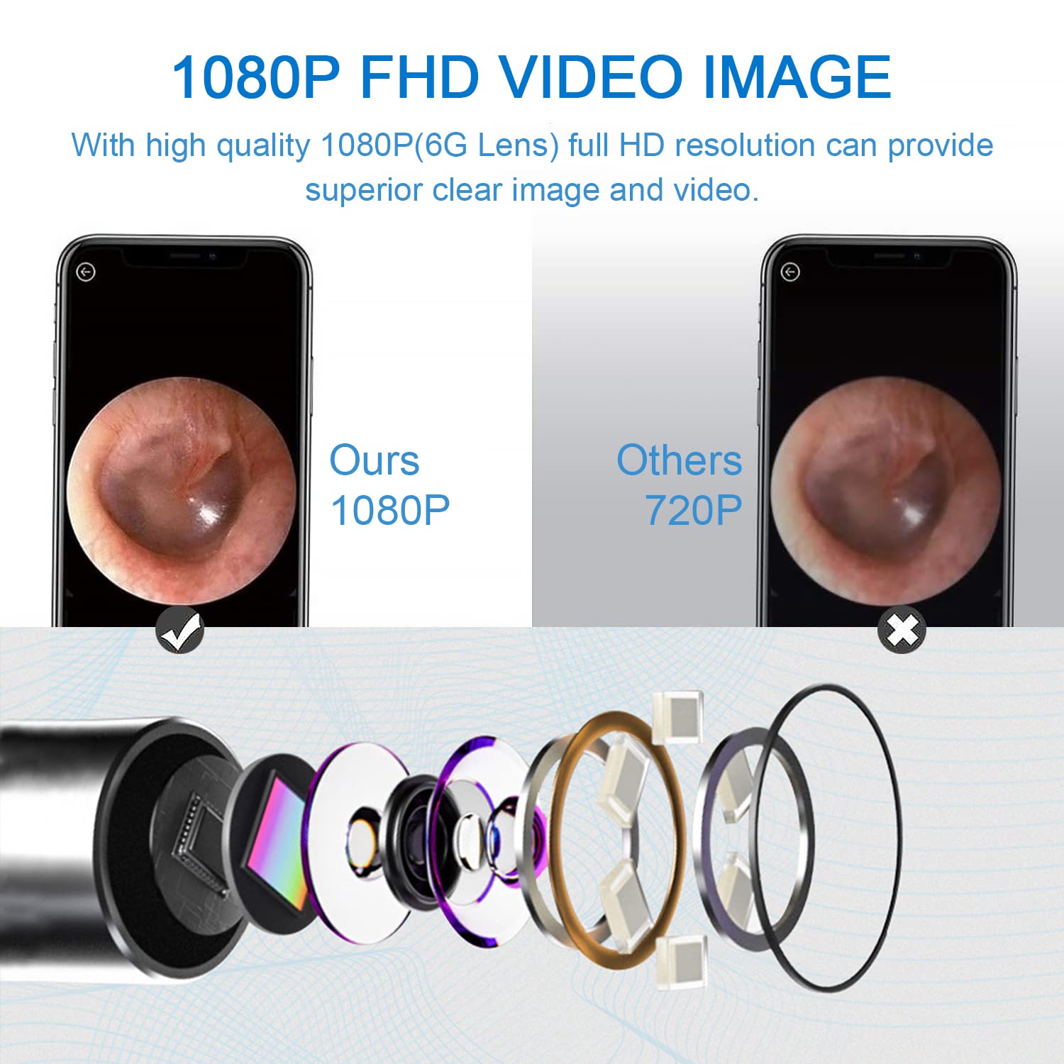 Oor Wax Visuele Oor Plukken Cleaner Met 1080P Hd Camera Oor Camera Otoscoop Met Licht, oor Wax Verwijderen Kit Iphone Ipad Android