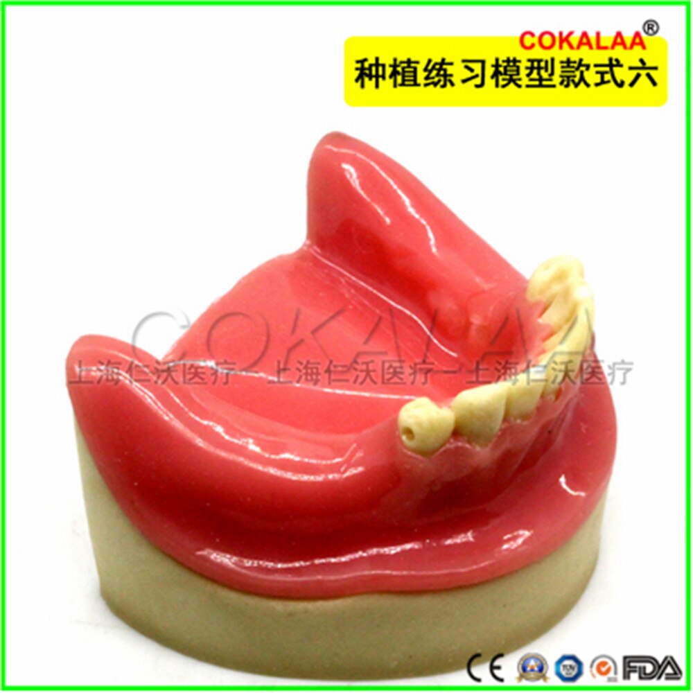 Matériel dentaire de bonne , modèle dentaire pour implant oral, chirurgie du sinus maxillaire, équipement pour les gencives souples, 1 pièces: D