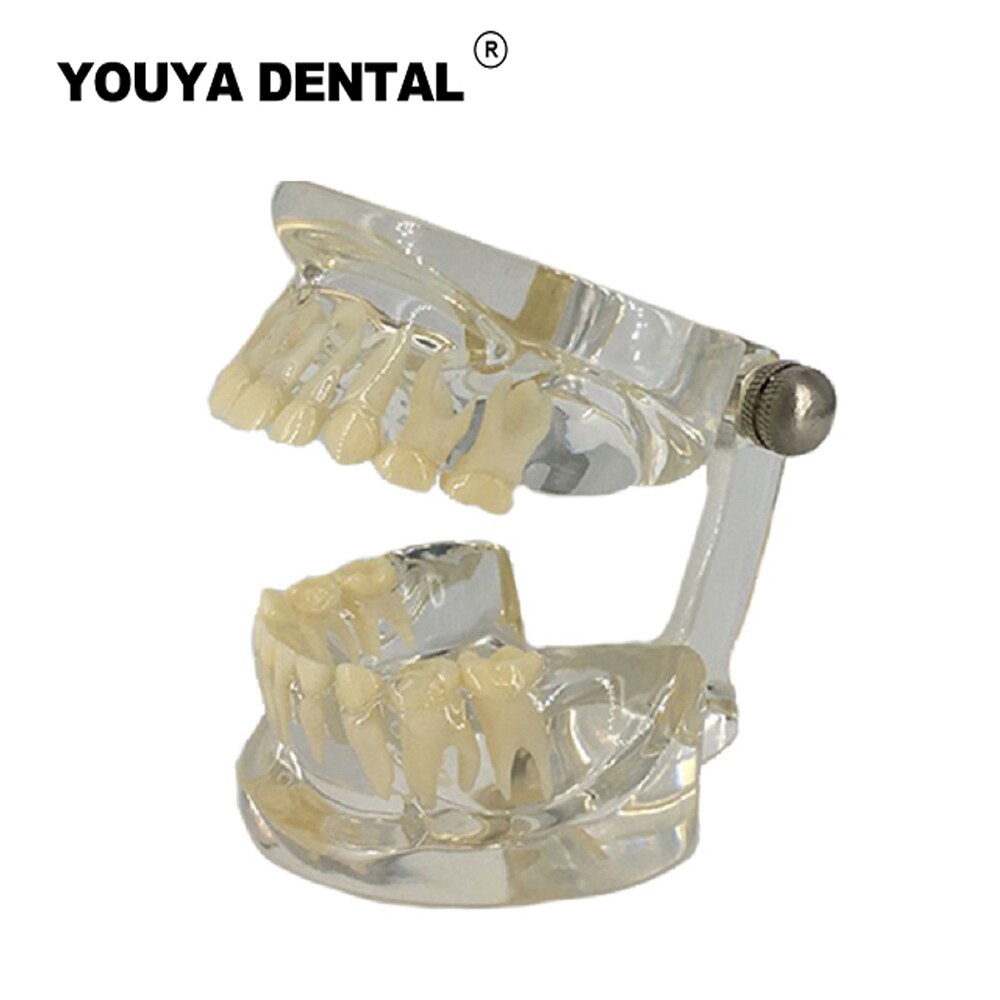 Dental Teaching Model Children Deciduous Tooth Permanent Teeth Alternating Study Pediatric Dental Pathology Preventive Model