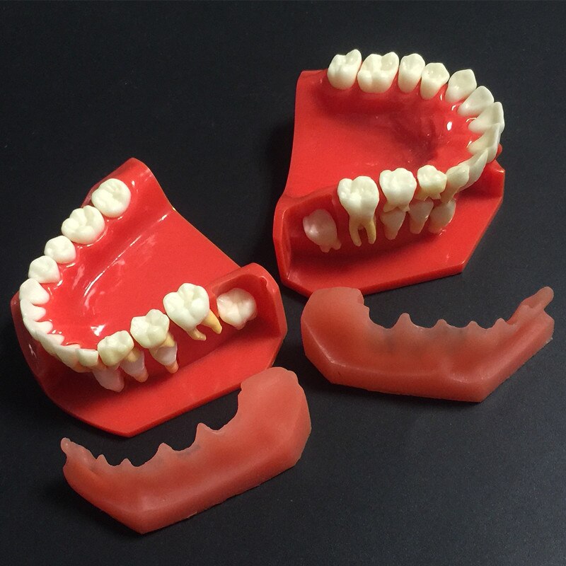 Goede Aankomst Tandheelkundige Tand Tanden Anatomie Anatomisch Model Kinderen Tandheelkundige Model