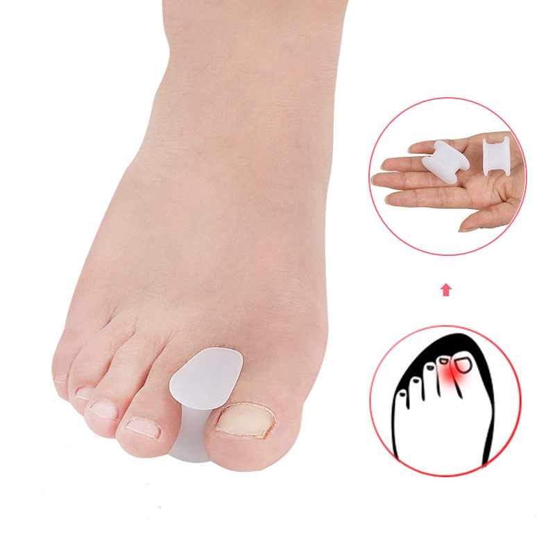Pexmen 2/4/10Pcs Gel Toe Separator Hallux Valgus Bunion Corrector Straightener Soft Silicone Toe Protector Spacer Foot Care Tool: light yellow