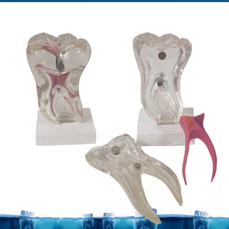 6X Zes Keer De Tand Zenuw Anatomie Onderwijs Model Pathologische Tandheelkundige Tand Tanden Anatomie Model Medische Anatomie Odontologia
