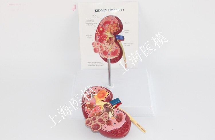 Nierziekte model urologie nier nephron renale glomerulus nier anatomisch model