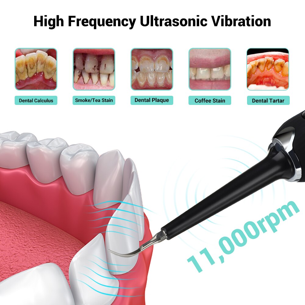 Portable Ultrasonic Tooth Cleaner Sonic Dental Scaler Oral Tartar Calculus Remover White Teeth Cleaning With Toothbrush Head