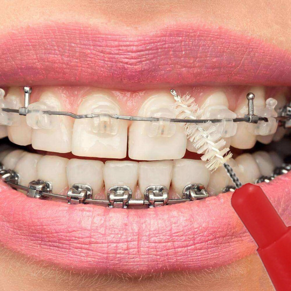 50 pc cepillo Interdental dientes palo cepillo Dental Ortodoncia de Cuidado Oral cepillo dientes Interdental entre los dientes cepillo de Cuidado Oral