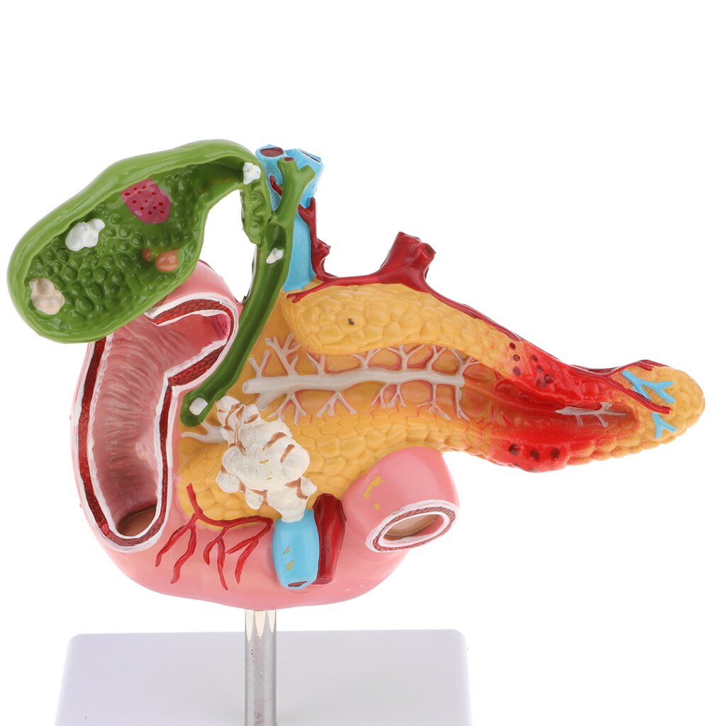 1:1 Human Pancreas Duodenum Gallbladder Pathological Anatomical Model Lab Supplies