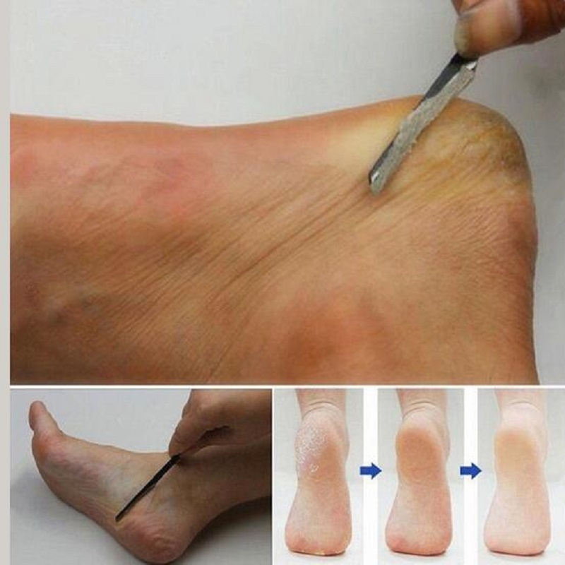 Pedicure manicure neglerenser neglebånd pleje død hud høvl skønhed fodpleje værktøj 16cm corta