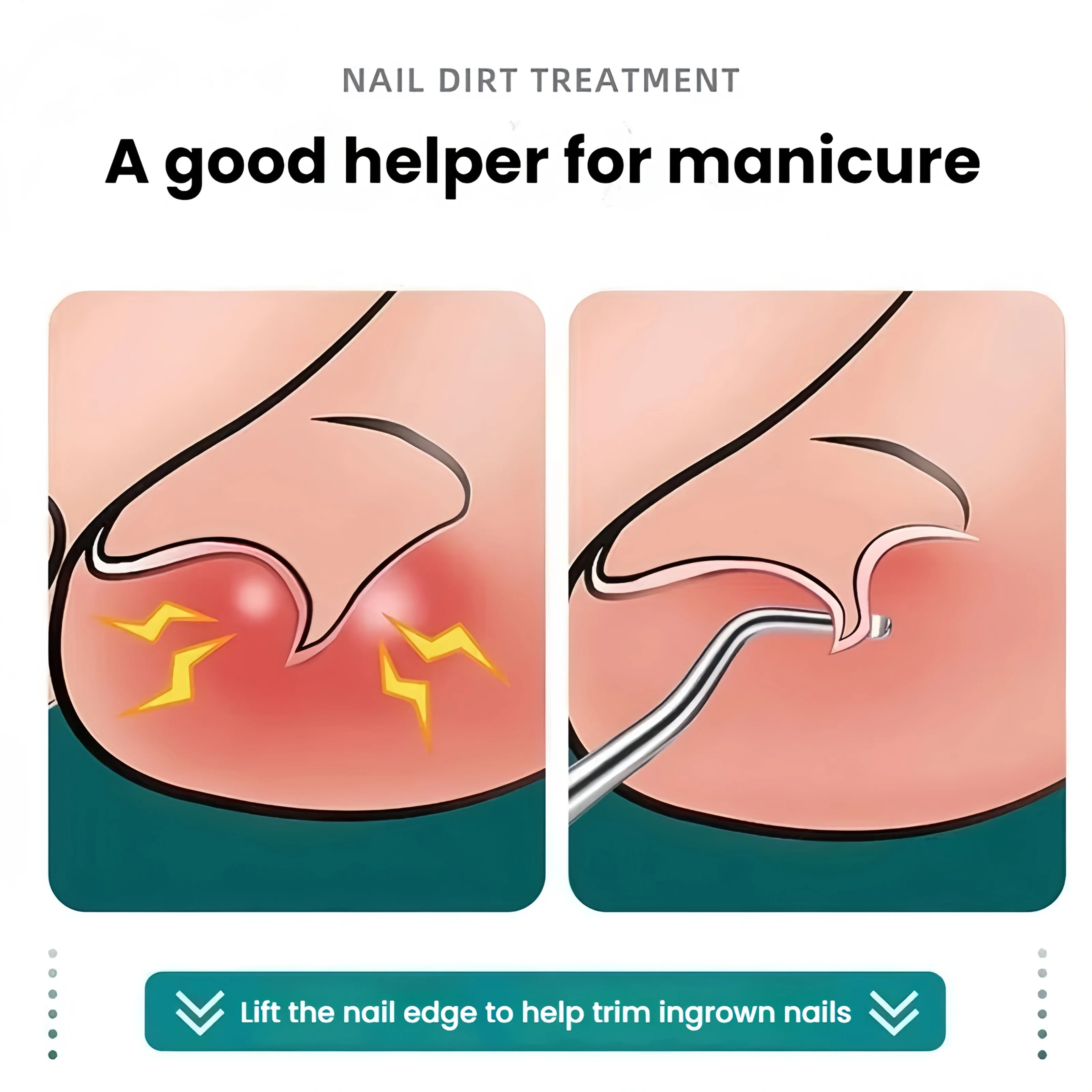 Herramientas de pedicura profesionales de acero inoxidable, cuchara curvada para limpieza profunda de uñas, levantador de uñas encarnadas, eliminación de suciedad de uñas de los pies