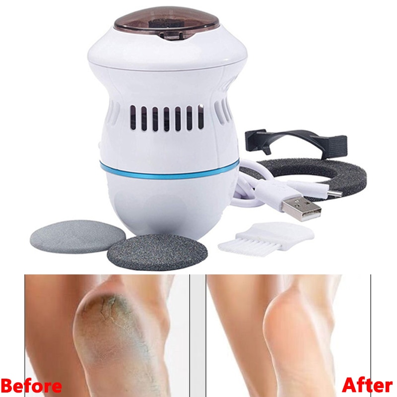 Pedikyr enhet usb-lading multifunksjonell elektrisk fotkvern maskin peeling død hud callus remover fotpleie