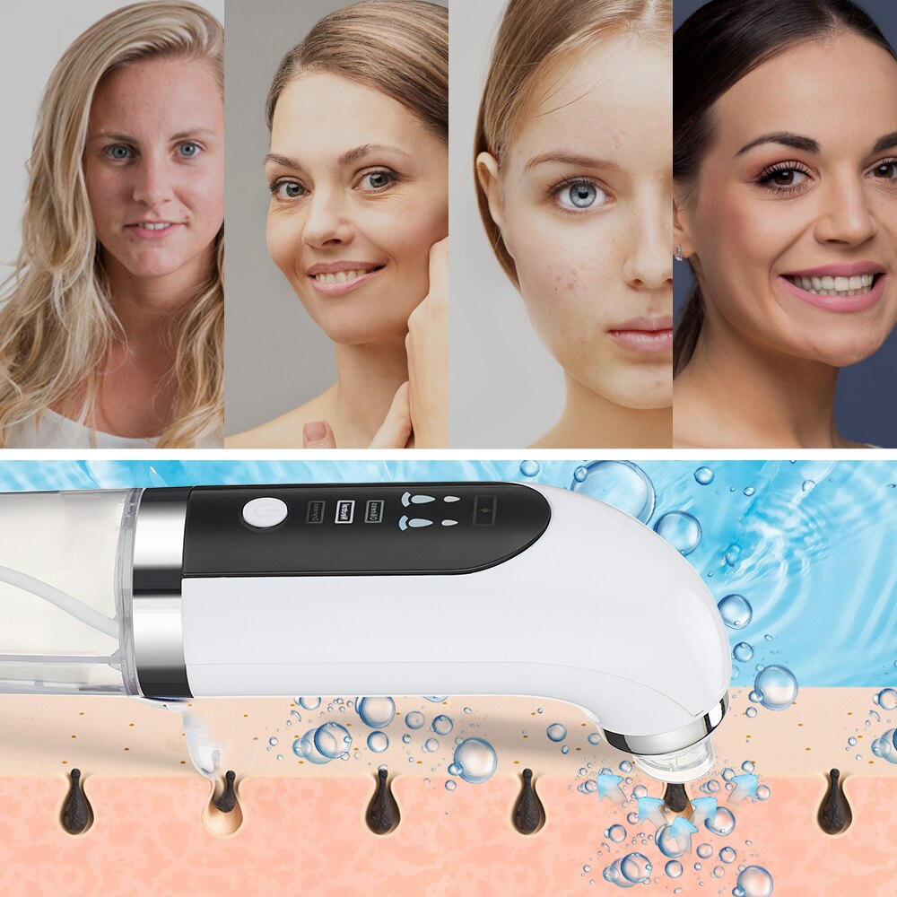 Blackhead Remover Nose Face Deep Cleaner Pore Acne Pimple Removal Vacuum Suction Facial Beauty Clean Skin Tool