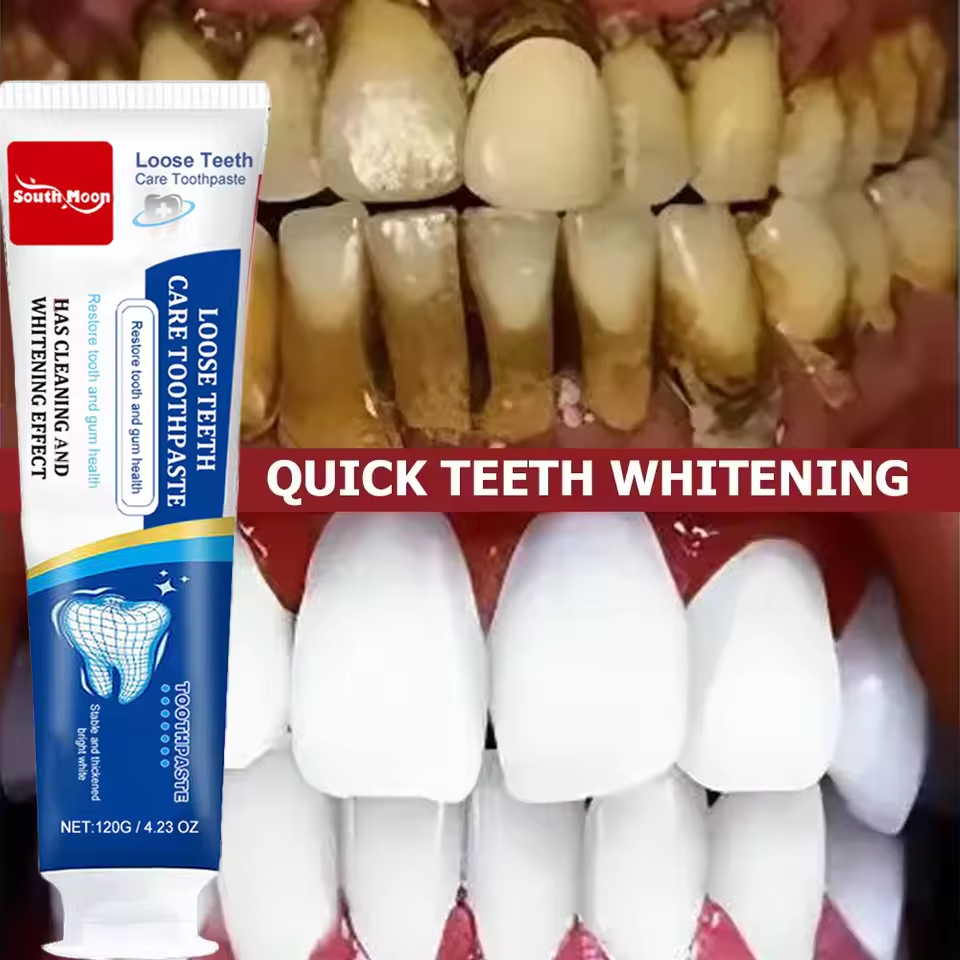 120 g probiotische Karies-Zahnpasta SP 4 aufhellende Zahnkaries-Reparaturpaste, Zahnreiniger, Plaque-Entferner, frischer Atem, Zahnpflege: RED