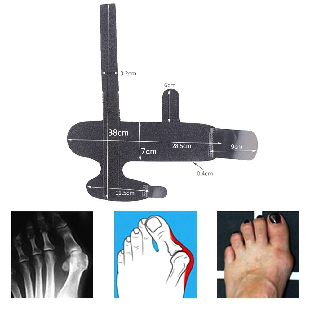 Yongrow bunion korrektori lasta suoristin tuki varpaat jalka peukalo ortoosi hallux valgus korrektori ortopediset työkalut 1 pari