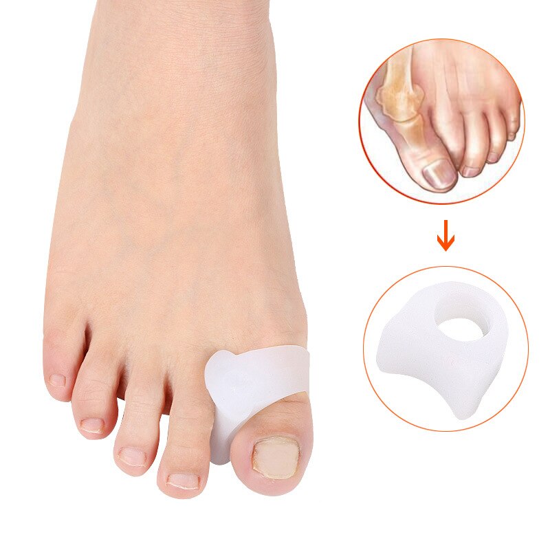 Separador de dedos dos pés para 20 peças = 10 pares, almofada de correção do espaçador de silicone, protetor ortopédico de joanete para cuidados com os pés e pedicure