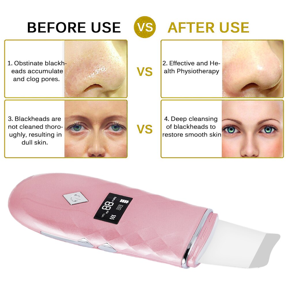 Deep Face Cleaning Skin Scrubber Facial Pore Cleaner Remove Dirt Blackhead Reduce Wrinkles Facial Lifting Beauty Instrument
