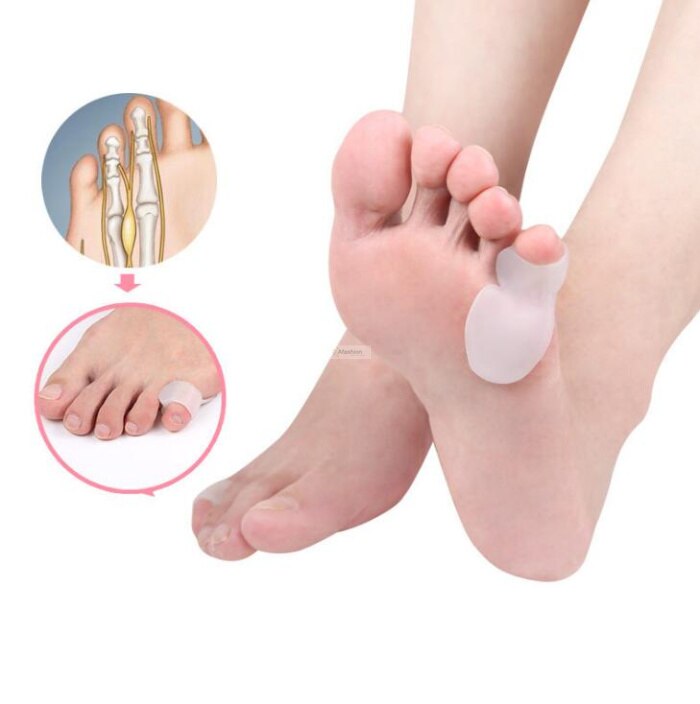 2 paar Siliconen Kleine teen correctie siliconen pad bescherming duim overlap teen separator voetverzorging gereedschap