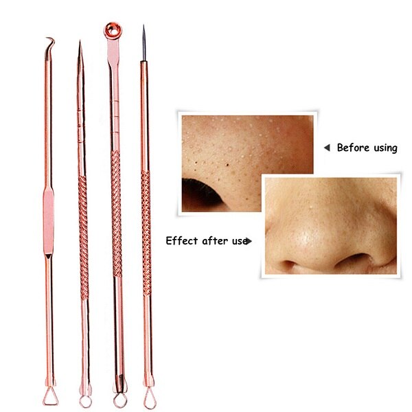 Stainless Steel Pimple Acne Extractor Blackhead Remover Needles Pimple Blemish Acne Treatments Face Skin Care Tools Needles Set: Style 3