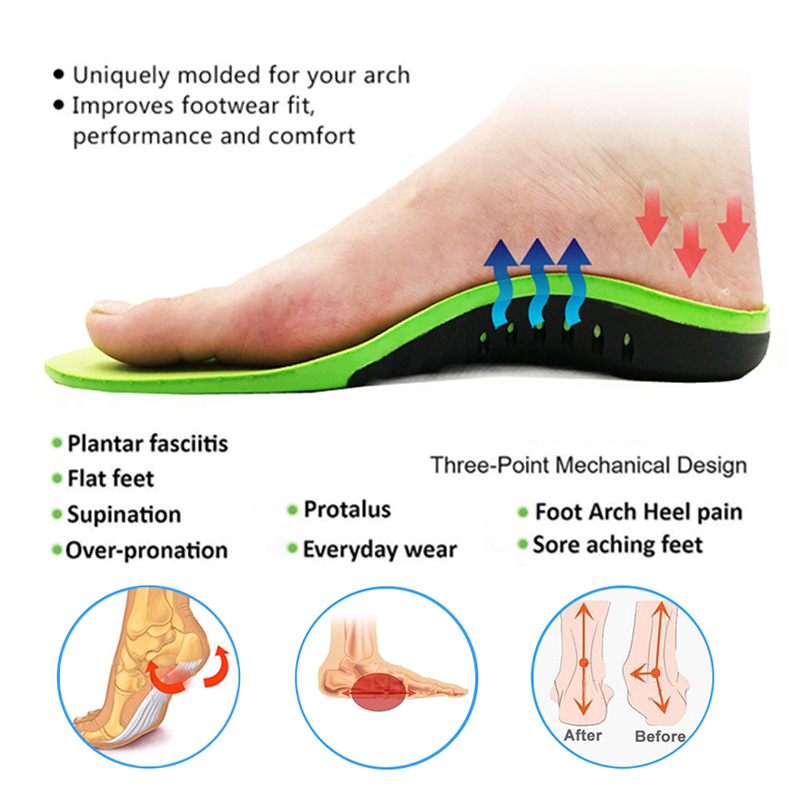 EVA Orthopädische Schuhe Sohle Einlegesohlen Für Füße Bogen Fuß Pad X/O Typ Bein Plattfuß Elastische Stoßdämpfung Bequeme Einlegesohlen