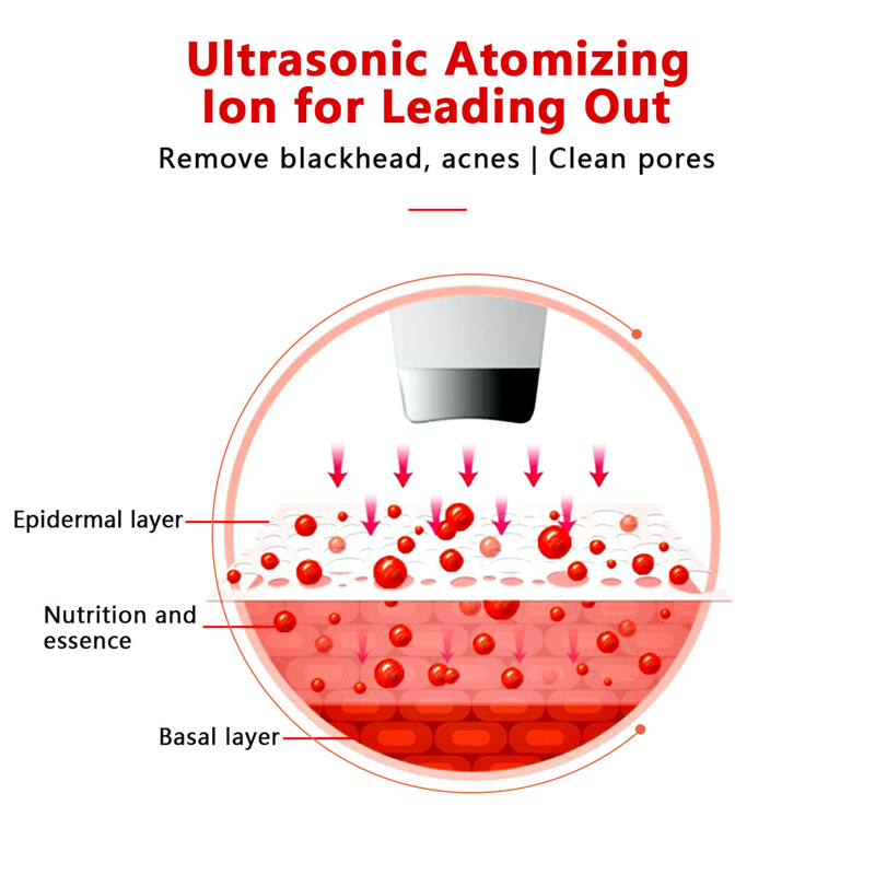 Ultraljud vibration pormask remover skrapa usb uppladdningsbar hud skrubber död hud peeling spade hud dra åt skönhetsverktyg
