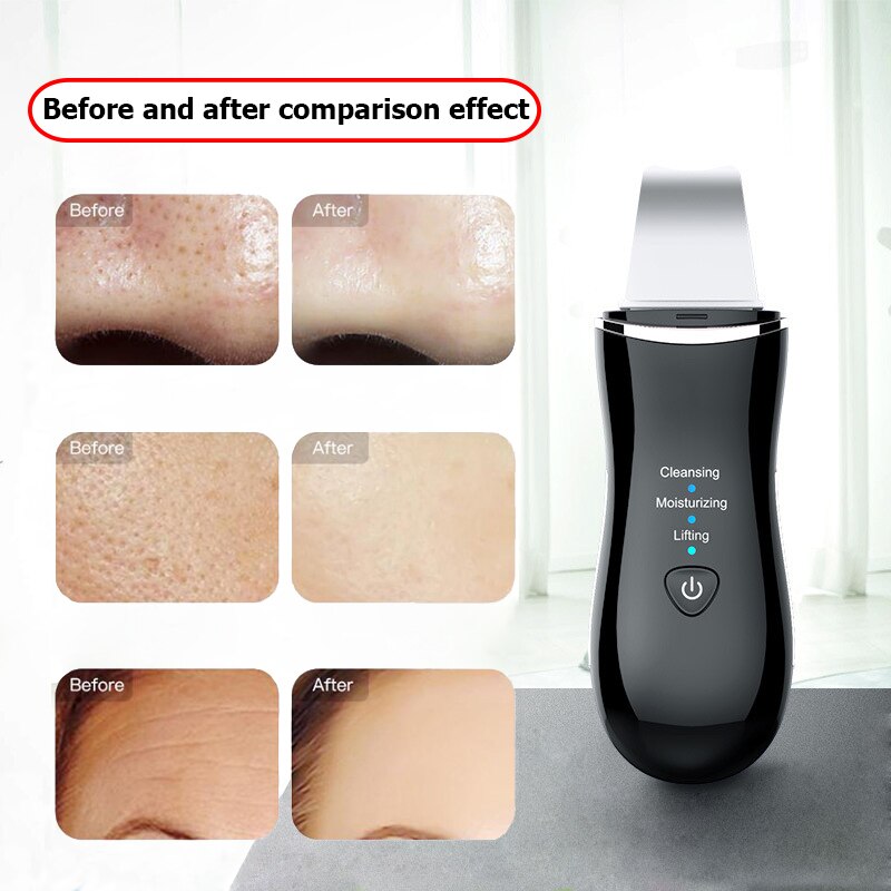 CF073 Facial Ultrasonic Skin Scrubber Microcurrent Face Massage Blackhead Remover Pores Cleaning Peeling Skin Care Beauty Tools