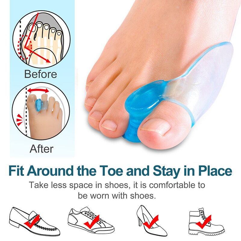 2pcs/Pair Silicone Toe Gel Correction Hallux Valgus Relief Pain Little Toe Pinkie Safe Repeated Use Finger Separator