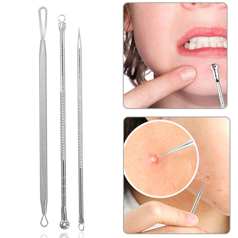 Stainless Steel Pimple Acne Extractor Blackhead Remover Needles Pimple Blemish Acne Treatments Face Skin Care Tools Needles Set