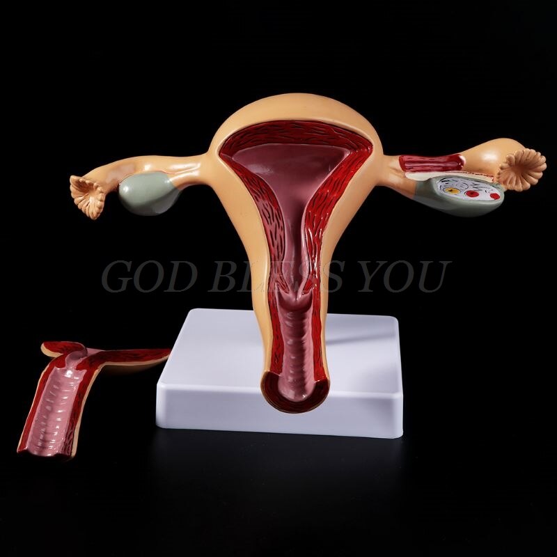 Human Pathological Uterus Ovary Model Anatomical Anatomy Disease Pathology Lesion For Teaching