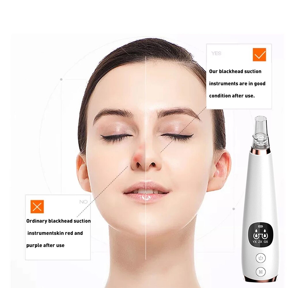 Blackhead Vacuum Cleaner Pore Ance Black Dots Extractor Facial Cleansing Pimple Remover Tool Nose Acne Remover Machine For Face