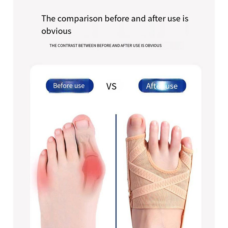 Stoff Ballen Korrektor Atmungsaktive verstellbare Hallux Valgus Ärmel Abstandshalter Separator Zehenkorrektur Sport Ballen Socken Laufen