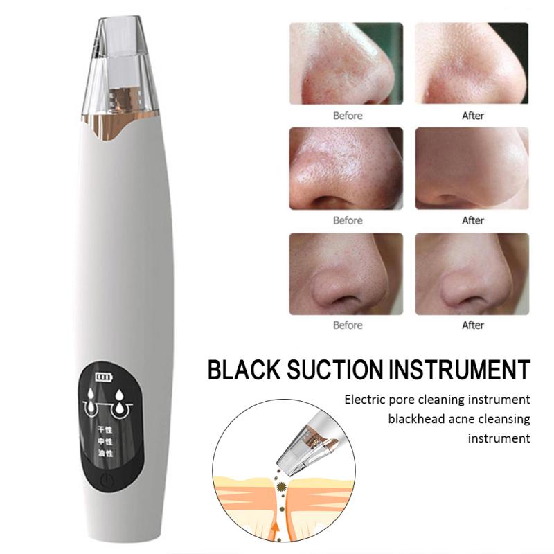 Electric Acne Remover Point Noir Blackhead Vacuum Extractor Tool Black Spots Pore Cleaner Skin Care Facial Pore Cleaner Machine