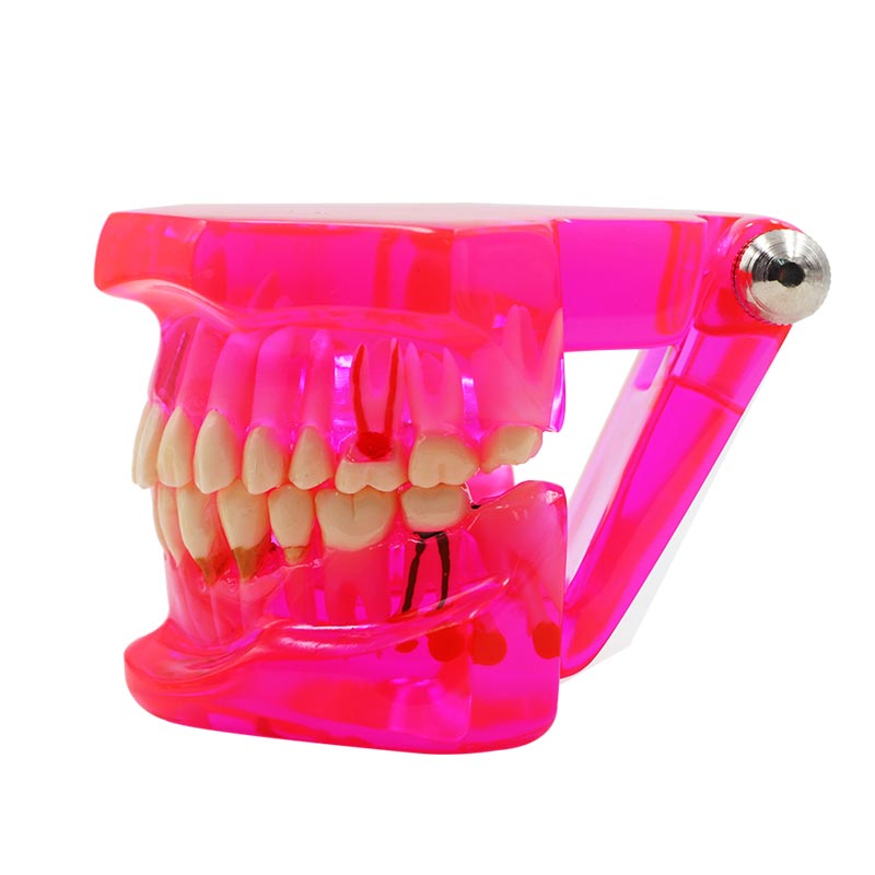 Modèle de dent multicolore, 1 pièce, modèle Standard d&#39;enseignement et d&#39;apprentissage dentaire pour adultes, utilisé dans les cliniques de stomatologie et de recherche