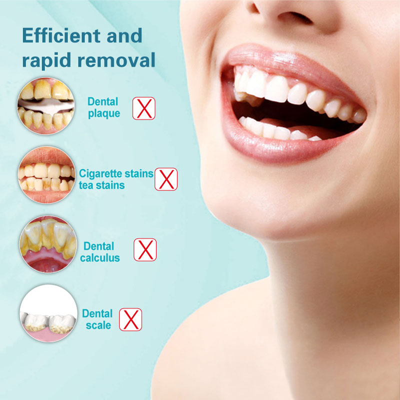 Sonic Dental Scaler Zahn Zahnstein Entferner Ultra sonic Wiederaufladbare Elektrische Zahnbürste Flecken Zahnstein Werkzeug Bleichen Zahn Reiniger